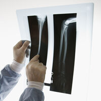 Workplace injuries cause 27 million working day loss in 2011/2012
